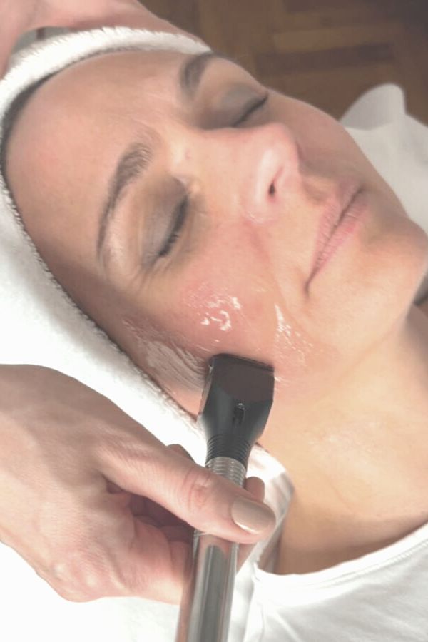 MicroNeedling-Radiofrequenz.jpg